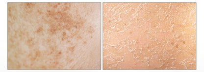 Medipeel+ / Melanon X Dark Spot Cream Patch — Parche Corrector de Manchas - Miroi Store